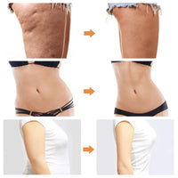 Nova Máquina de lipoaspiração queimador de gordura, modelador, emagrecedor e anti celulite