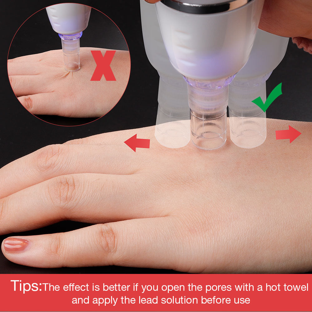 Novo Removedor digital indolor com limpeza profunda dos poros e remoção de cravos, acnes e marcas.